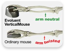 Evoluent Vertical Mouse